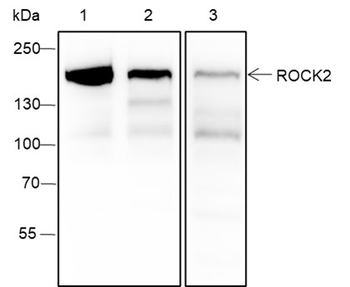 ROCK2 Mouse Monoclonal Antibody