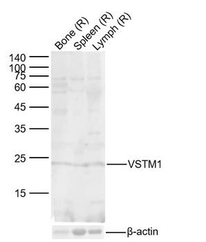 VSTM1 antibody