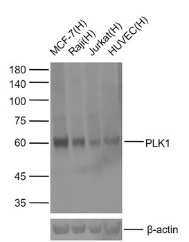 PLK1 Mouse Monoclonal Antibody