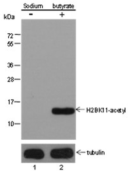 Histone H2B (Acetyl K11) Rabbit Polyclonal Antibody