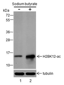Histone H2B (Acetyl K12) Rabbit Polyclonal Antibody
