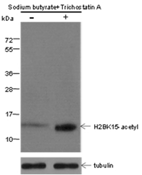 Histone H2B (Acetyl K15) Mouse Monoclonal Antibody