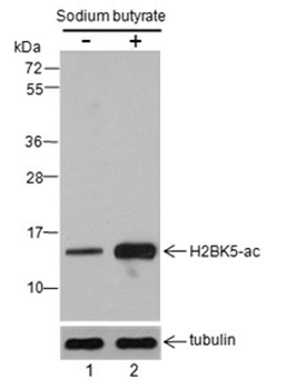 Histone H2B (Acetyl K5) Rabbit Polyclonal Antibody
