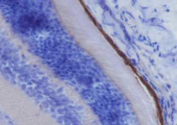 RPE65 Rabbit Polyclonal Antibody
