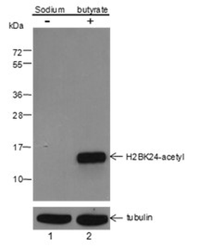 Histone H2B (Acetyl K24) Rabbit Polyclonal Antibody