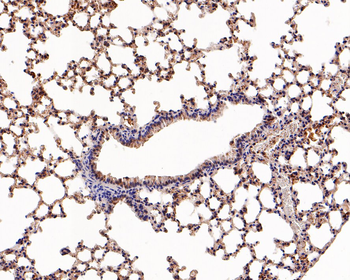 FABP4 Recombinant Rabbit Monoclonal Antibody