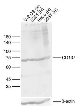 NF2 Rabbit Polyclonal Antibody