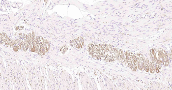 Tau-4 Mouse Monoclonal Antibody