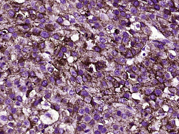 TRP2 Rabbit Polyclonal Antibody