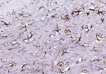 GFAP Recombinant Rabbit Monoclonal Antibody