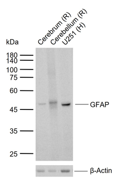 GFAP Recombinant Rabbit Monoclonal Antibody