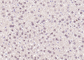 Thioredoxin Rabbit Polyclonal Antibody