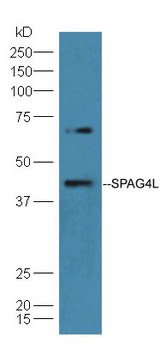 SPAG4L/SRG4 Rabbit Polyclonal Antibody