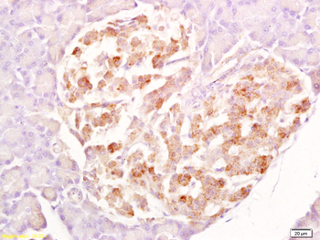 SPAG4L/SRG4 Rabbit Polyclonal Antibody