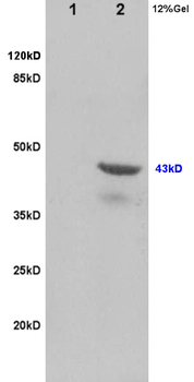 TSG101 Rabbit Polyclonal Antibody