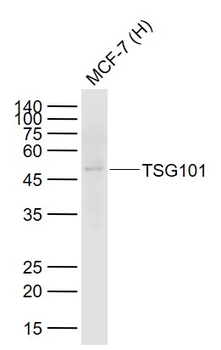 TSG101 Rabbit Polyclonal Antibody