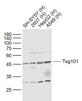 TSG101 Rabbit Polyclonal Antibody