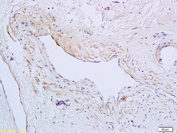 TSLC1 Rabbit Polyclonal Antibody
