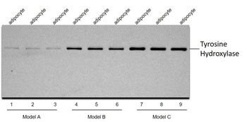 Tyrosine Hydroxylase Rabbit Polyclonal Antibody