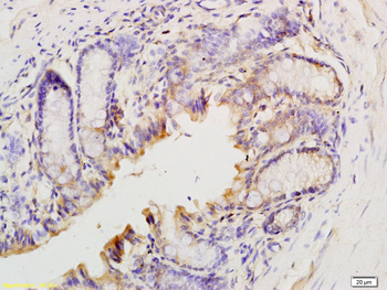 T Beta 10 Rabbit Polyclonal Antibody