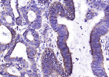 Galectin 9 Rabbit Polyclonal Antibody