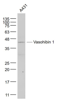 Vasohibin 1 Rabbit Polyclonal Antibody