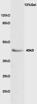 Vasohibin 1 Rabbit Polyclonal Antibody