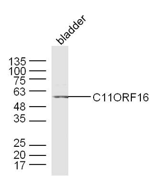 C11ORF16 Rabbit Polyclonal Antibody