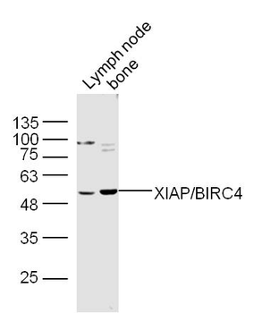 XIAP/BIRC4 Rabbit Polyclonal Antibody