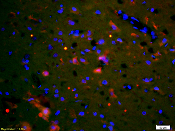XIAP/BIRC4 Rabbit Polyclonal Antibody