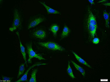 XIAP/BIRC4 Rabbit Polyclonal Antibody