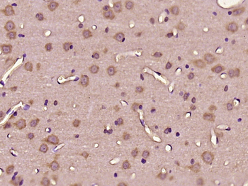 C11orf57 Rabbit Polyclonal Antibody