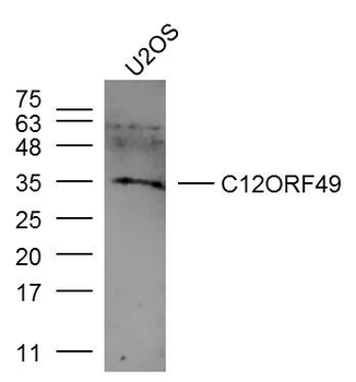 C12ORF49 Rabbit Polyclonal Antibody