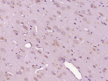 C12ORF50 Rabbit Polyclonal Antibody