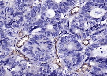 CD105 Rabbit Polyclonal Antibody