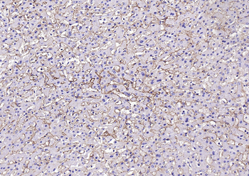 CD105 Rabbit Polyclonal Antibody