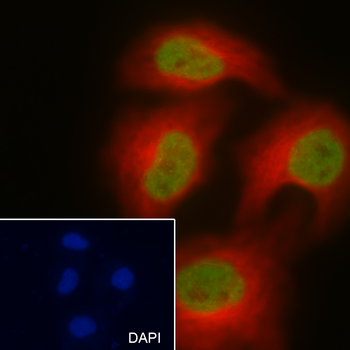 Acetyl-Histone H3 (Lys18) Mouse Monoclonal Antibody
