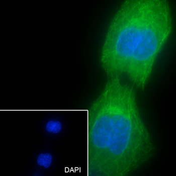 Keratin 15 Recombinant Rabbit Monoclonal Antibody