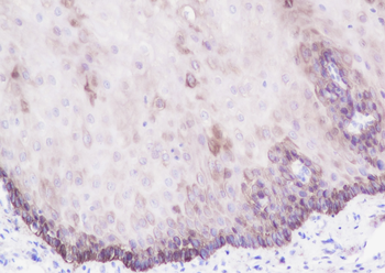 Keratin 15 Recombinant Rabbit Monoclonal Antibody