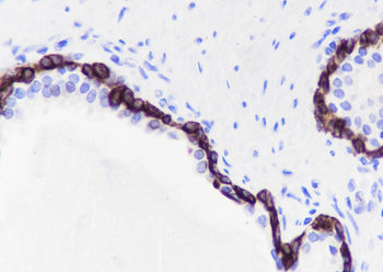 Keratin 15 Recombinant Rabbit Monoclonal Antibody