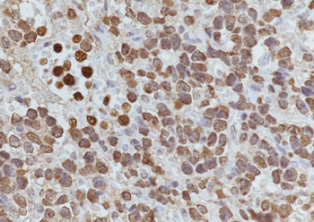 Acetyl-Histone H4 (Lys12) Mouse Monoclonal Antibody