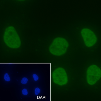 Acetyl-Histone H3 (Lys14) Mouse Monoclonal Antibody