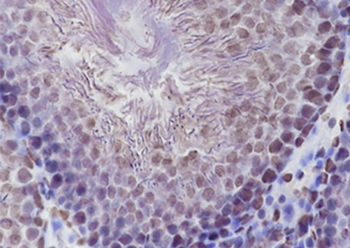 TRIM24 Recombinant Mouse Monoclonal Antibody