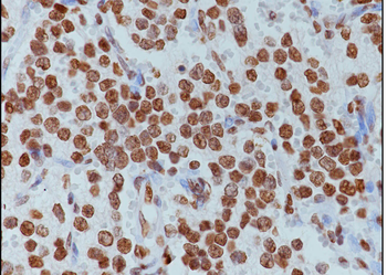 Di-Methyl-Histone H3 (Lys79) Rabbit Polyclonal Antibody