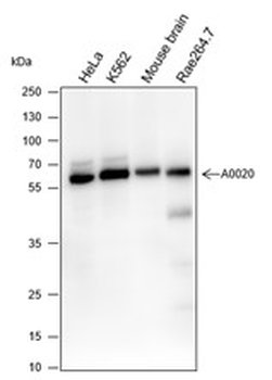 ELP3 Recombinant Rabbit Monoclonal Antibody