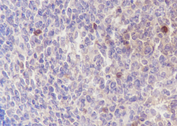 ELP3 Recombinant Rabbit Monoclonal Antibody