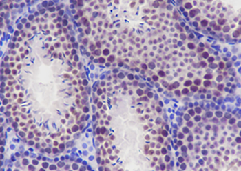 ELP3 Recombinant Rabbit Monoclonal Antibody