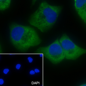 BCLG Recombinant Mouse Monoclonal Antibody