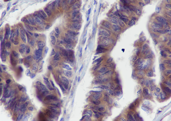 BCLG Recombinant Mouse Monoclonal Antibody