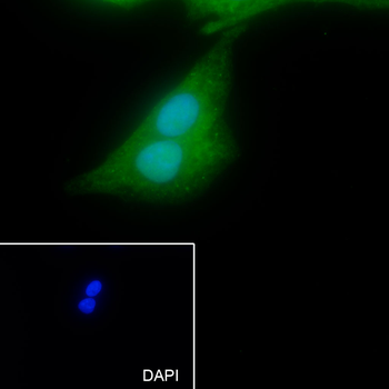 SBDS Recombinant Mouse Monoclonal Antibody